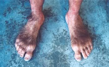 Feet.jpg