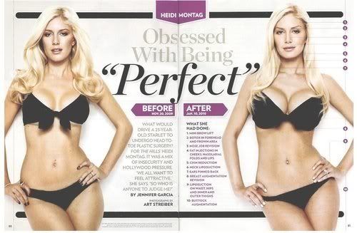 heidi montag before and after 10. heidi montag before. to last