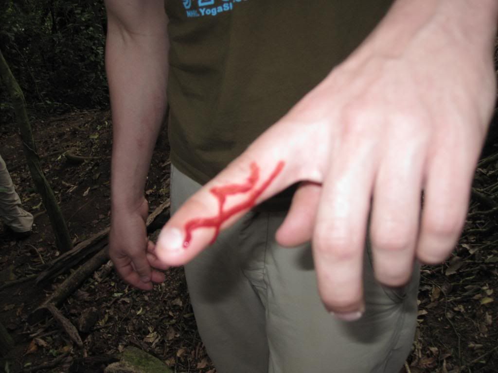 Photos+of+Cow+Ant+Bites Cow Ant Bite http://www.profilekiss.com/picture/code-31/leaf+cutter ...